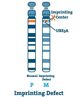 genomic imprinting angelman syndrome