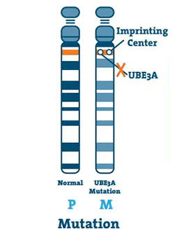 Angelman syndrome type: Mutation